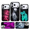 Artă radiologică estetică Carcasă Telefon Craniu Pentru iPhone 17 AIR 16 Pro Max 15 14 Pro 11 12 13 Capac Silicon Antișoc