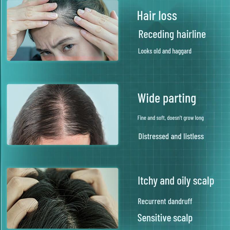 CHANDO Scalp Care Anti-Hair Loss Shampoo