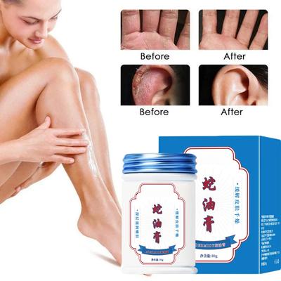 Schönheitsprodukt Pflanzliche Anti-Riss-Fußcreme Fersenriss-Reparaturprodukte Peeling Abgestorbene Haut entfernen Erweichen Befeuchten