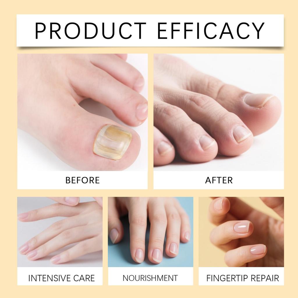 Flüssig-Set zur Nagelpflege Effektive Reparatur von Nägeln Vorbeugung von Nagelbruch Sanfte tägliche nährende Pflege Feuchtigkeitsspendende Nagelpflege-Lösung