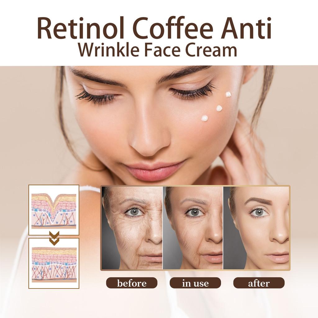 Eelhoe Retinol Coffee Anti-aging Cream For Smooth Skin Wrinkle Reduction And Repair