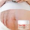 Bestselgende Naturlig Organisk Anti Pregnant Scar Skin Care Repair Treatment Cream