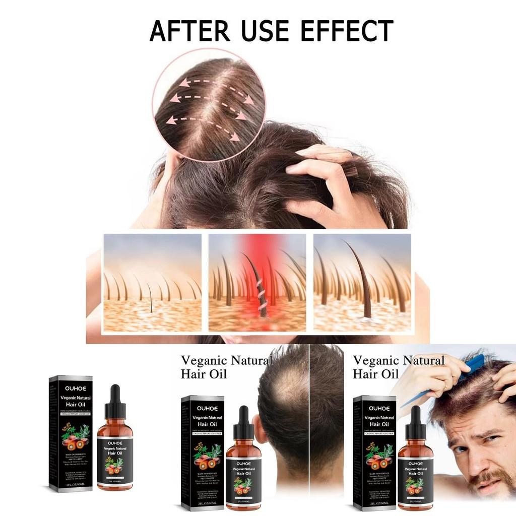 Ouhoe Nourishing Hair Oil For Strong And Resilient Hair With Thickening Essence 60ml