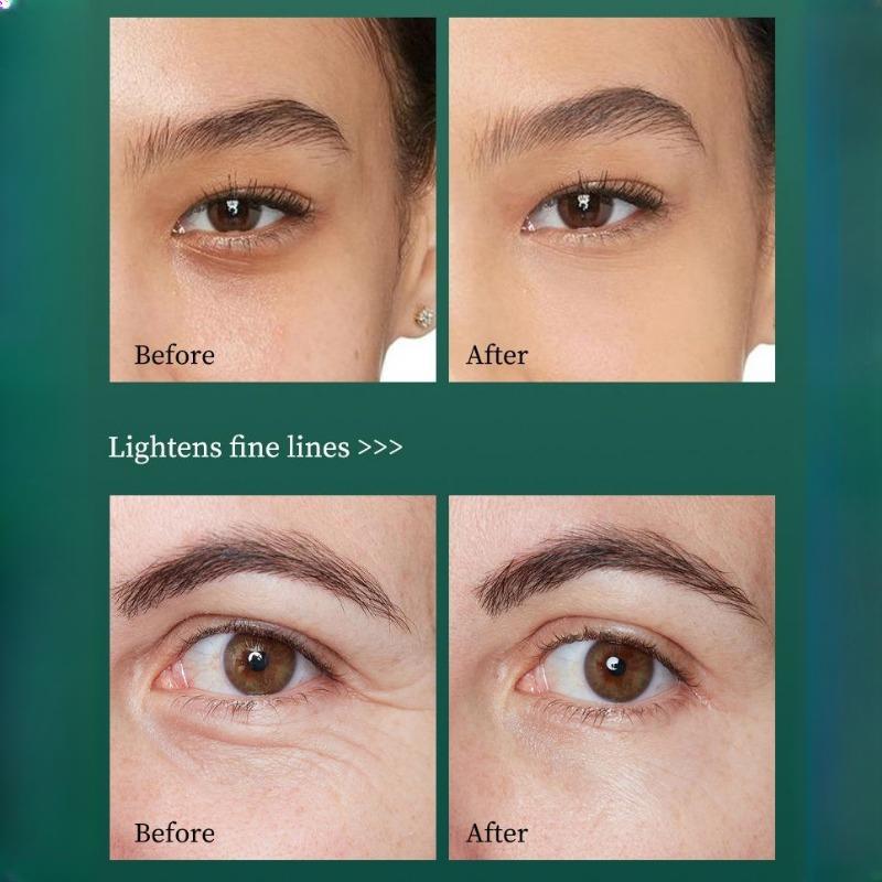 O'CHEAL Retinol Eye Cream Moisturising Fade Dark Circles Brightening Improve Fine Lines Essence Eye Cream