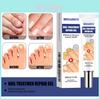 West Month Grijze Nagelherstelcrème Voor Gezonde Glanzende Nagels En Voedende Verzorging