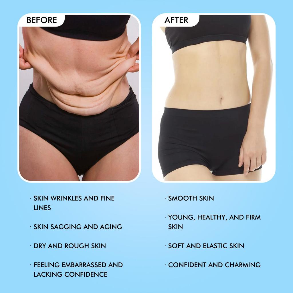 Anti-Aging Body Firming Cream - Anti-Wrinkle Hydrating Moisturizing, Deep Nourishing Firming Brightening Rejuvenating Skin