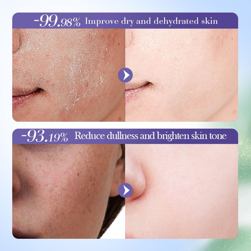 Blueberry Hyaluronic Acid Toner 125mSADOER Moisturizing Antioxidant Moisturizing Water