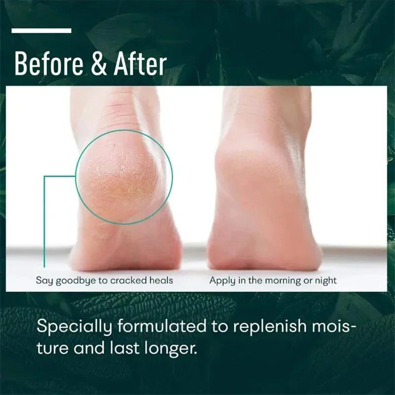 Crema Piedi Antifessure alle Erbe Prodotti Riparatori per Talloni Screpolati Esfoliazione Rimozione Pelle Morta Ammorbidimento Idratazione Cura della Pelle Liscia