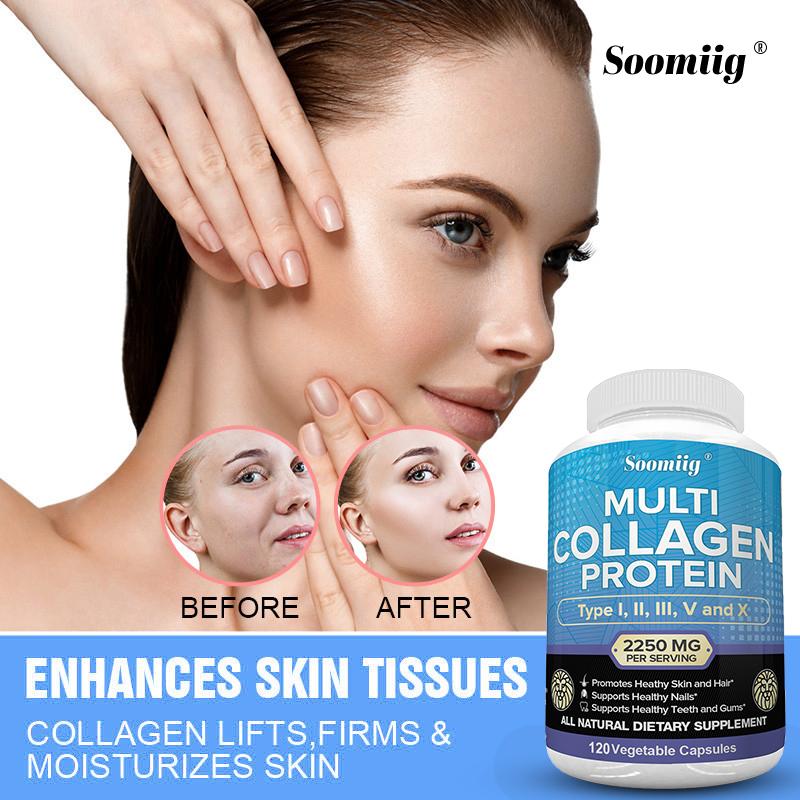 Multi-Collagen Peptides (Types I, II, III, V, X) — Anti-Aging Collagen 120 Capsules