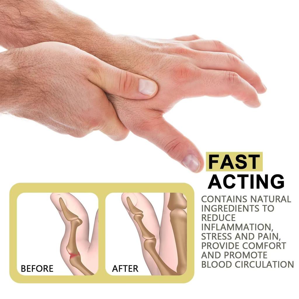 Gout Pain Patch Treatment Foot Gout Patch Thumb Corrector Sticker Finger Hallux Toe Bunion Pain Relief Plaster Patch