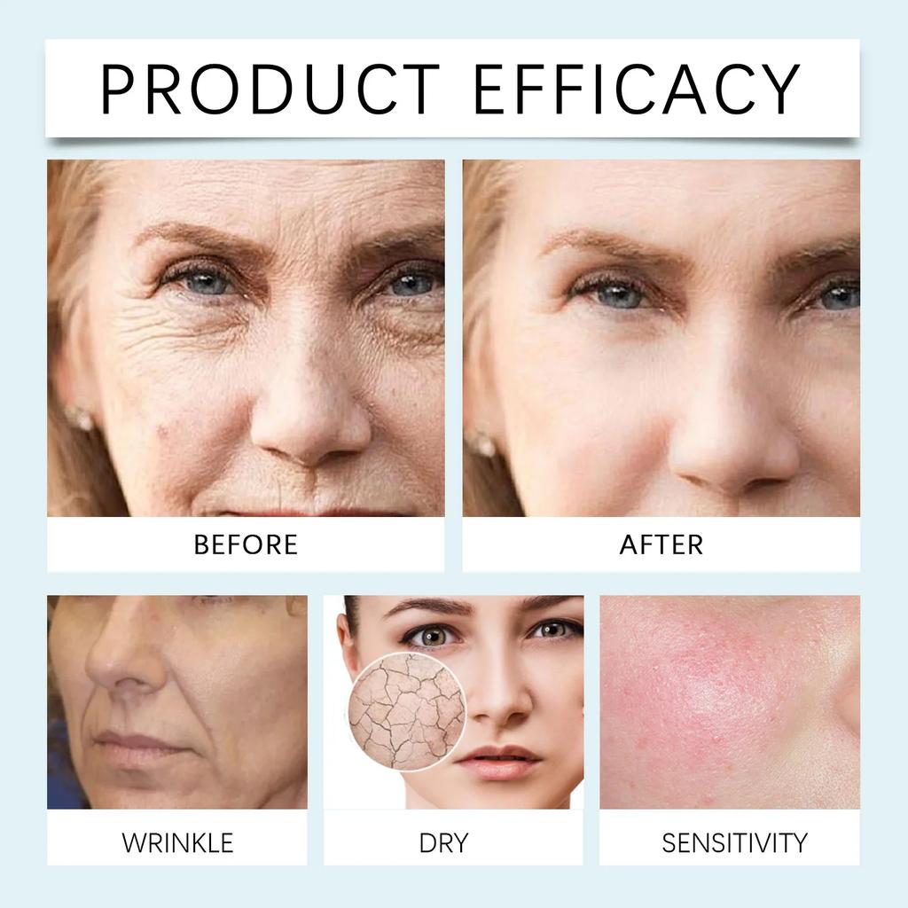 OUHOE Hyaluronic Acid Serum Moisturizing Hydrating Firming Improving Skin Softening Lifting Skin Applying Serum Fade Fine Lines