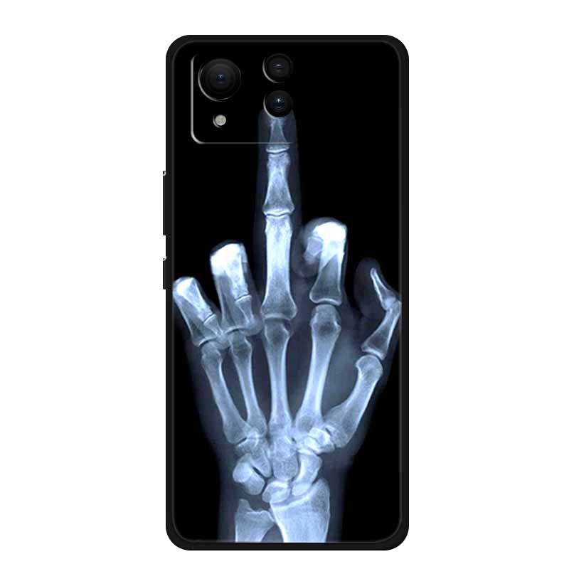 Case For Asus Zenfone 11 Ultra 5G Fashion Painted Wolf Silicone Soft Bumper for Zenfone 11 Ultra Protector Capa ZenFone 11 Ultra