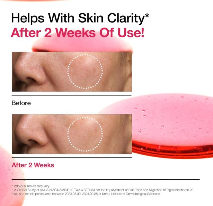 Anua Niacinamide 10%+TXA 4% Dark Spot Correcting Serum 30ml