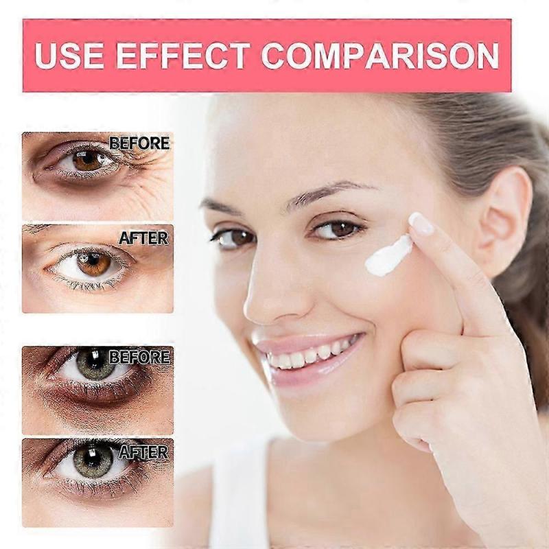 Retinol Anti-Wrinkle Eye Cream for Dark Circles & Puffiness, Anti-Aging Lifting Firming, Brightening Moisturizing Eye Care