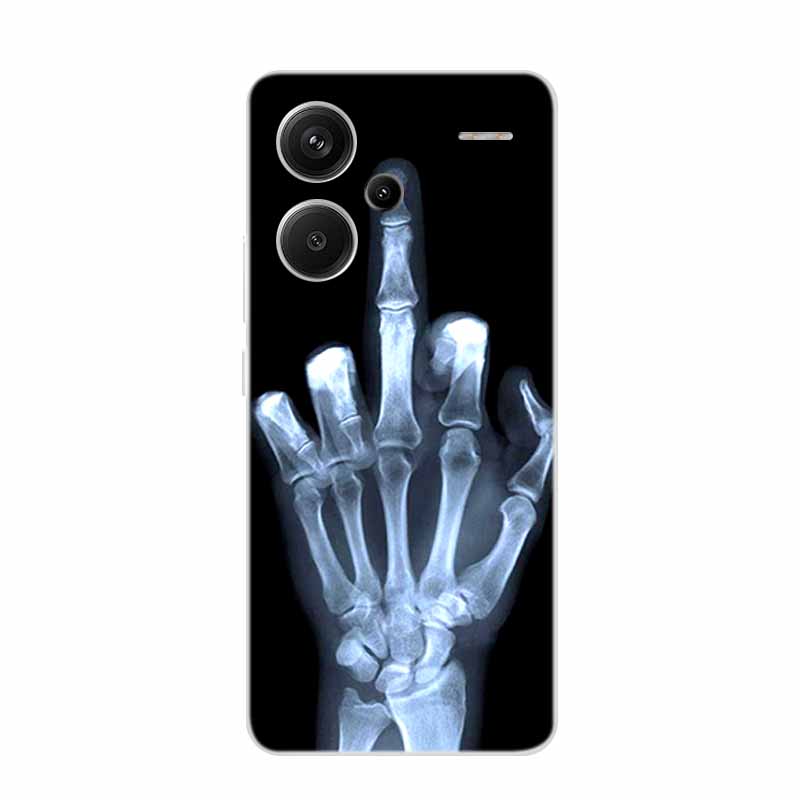 For Xiaomi Redmi Note 13 Pro+ Case Note13 Pro Plus Clear Silicone Soft TPU Coque For Redmi Note 13 Pro Plus 5G Back Cover Case