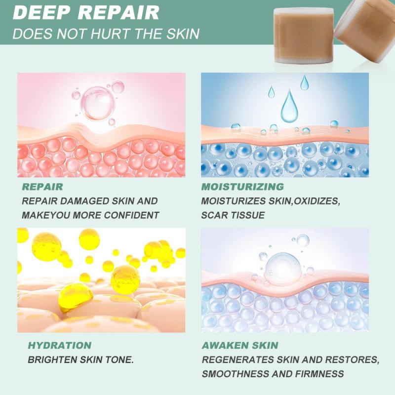 1 Roll 150/300cm Silicone Scar Sheets Medical Grade, Reusable Scar Tape For Keloid, C-Section, Surgery, Burn, Acne Waterproof