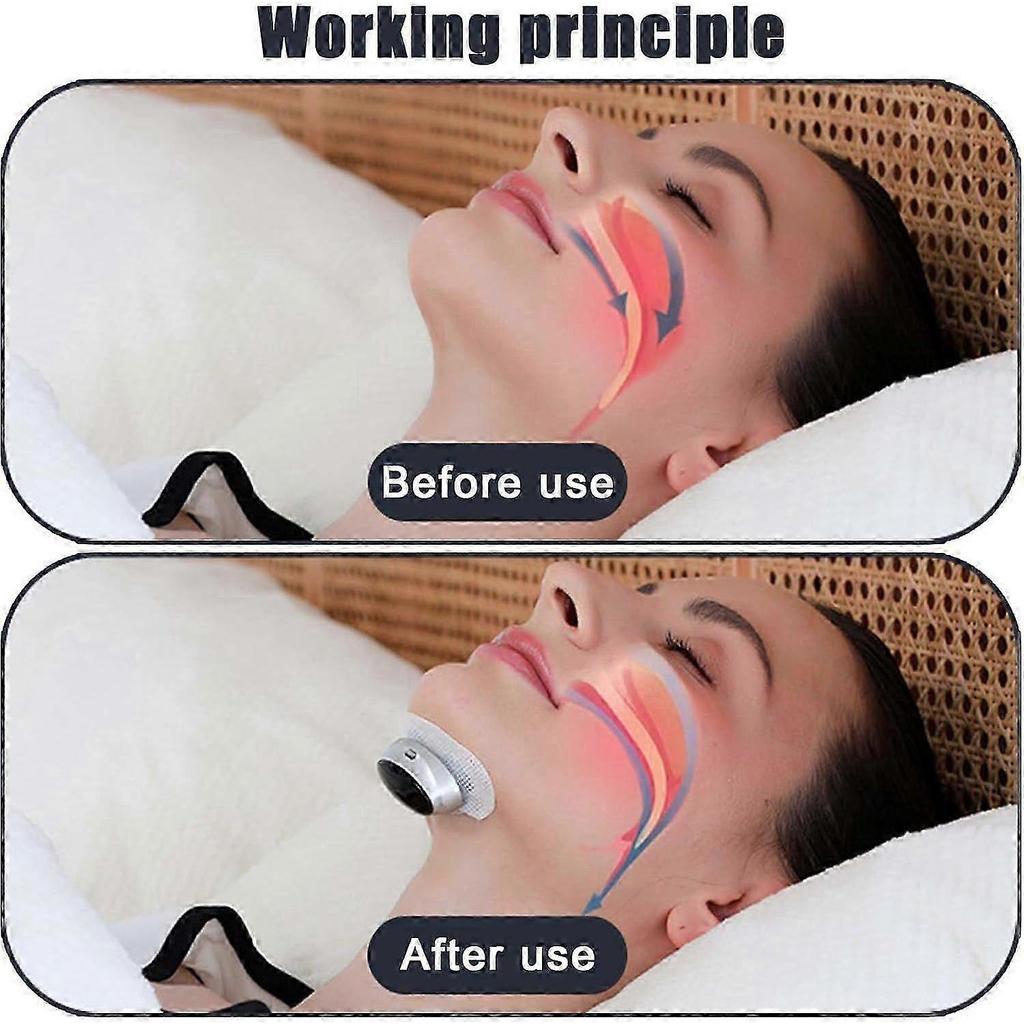 2025 Latest Model Smart Guard Anti Snore Device, Professional Anti-Snoring