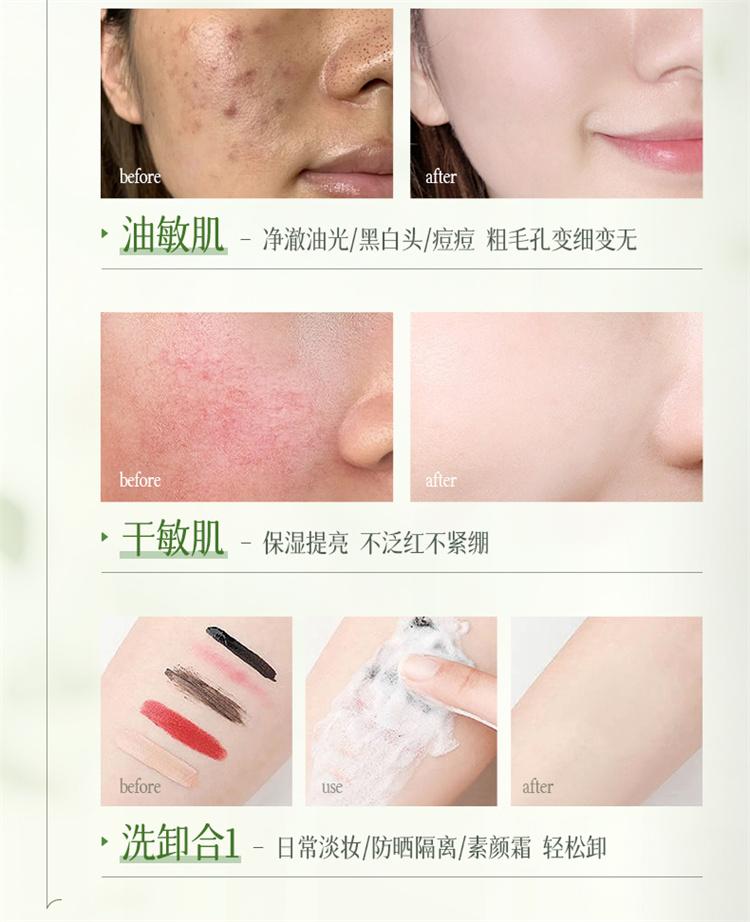 RUYI Amino Acid Moisturizing Cleansing Mousse Facial Cleanser 300ml