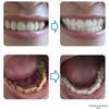 Tong Ren Tang Whitening & Stain Removal Toothpaste