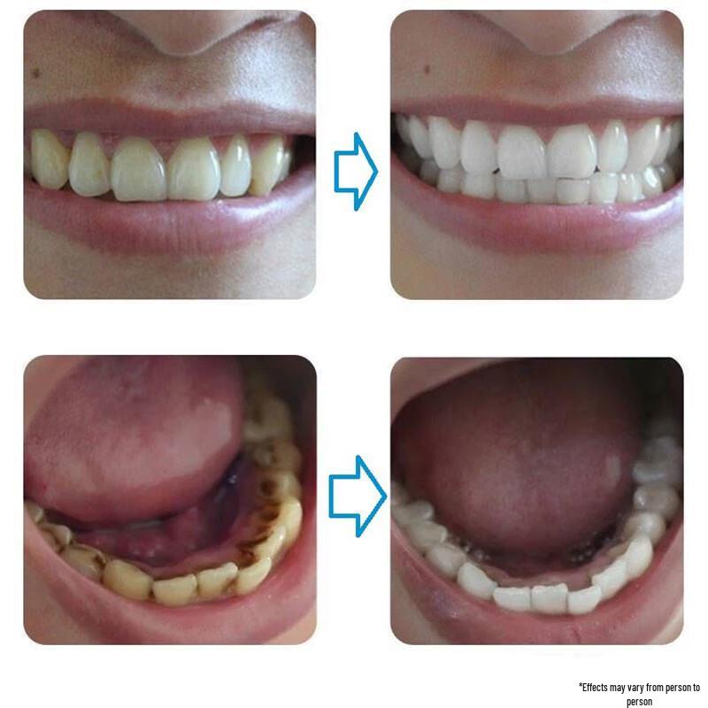 Tong Ren Tang Whitening & Stain Removal Toothpaste