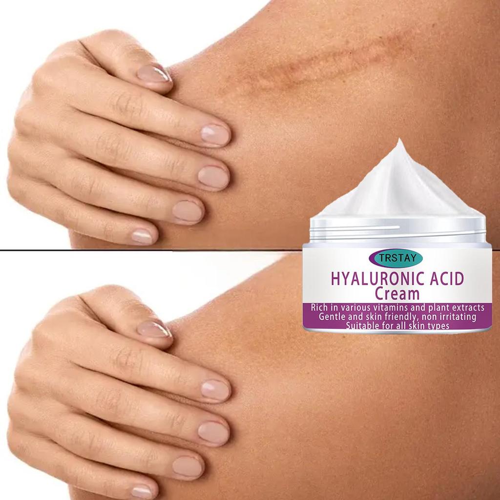 Krem do naprawy blizn Zniknie blizna po oparzeniu Nawilżająca naprawa usuwa cellulit