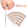 9pcs   Set Ingrown Toenail Correction Stickers Ingrown Toenail Patch Planing Tool