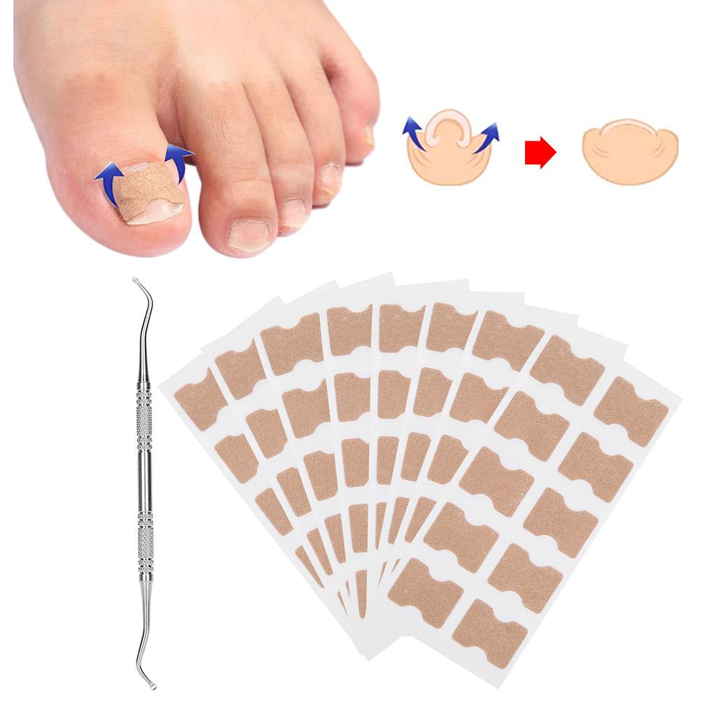 9pcs Set Ingrown Toenail Correction Stickers Ingrown Toenail Patch Planing Tool