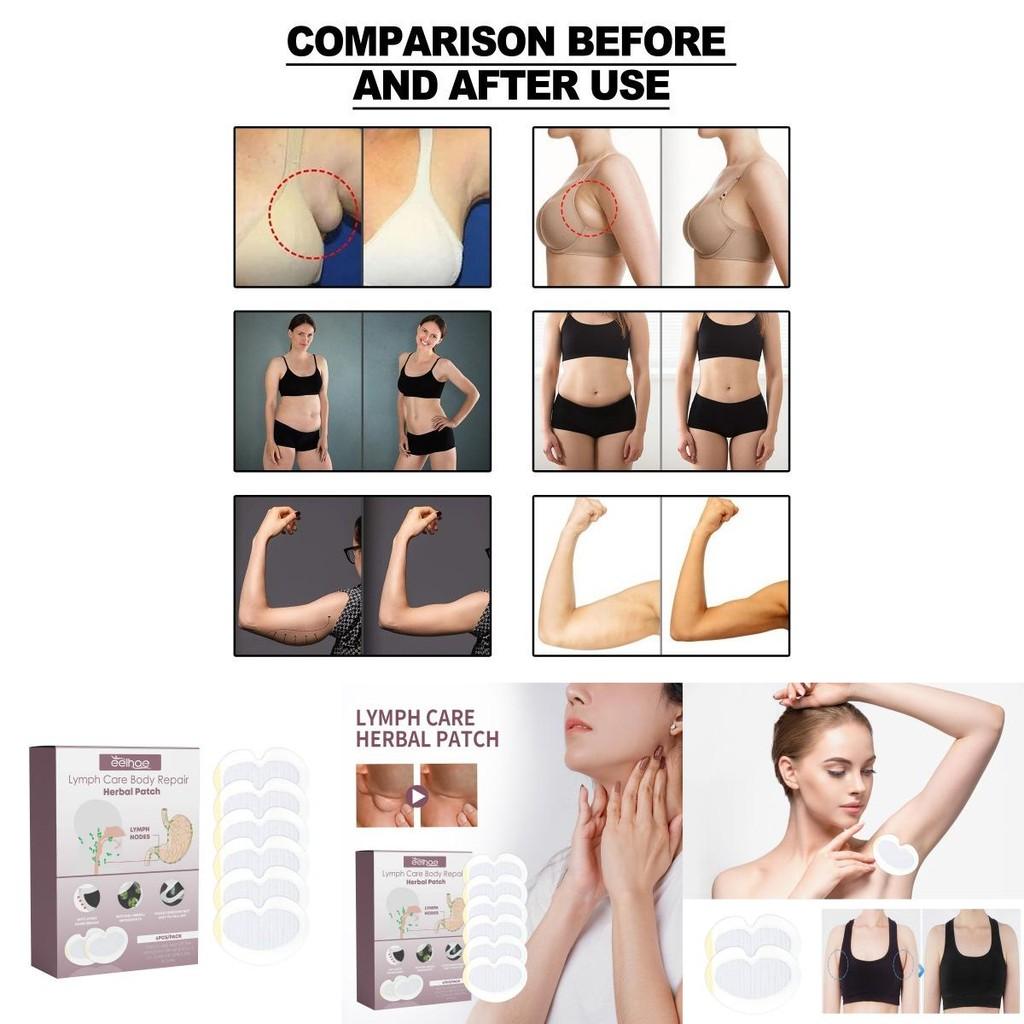 Plasturi Eelhoe pentru Îngrijirea Corpului Limfatic Alinare Confortabilă Pentru Zone Umflate ale Gâtului și Axilelor