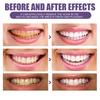 Oralhoe Purple Teeth Cleaning Powder Fresh Breath Tartar Calculus White Teeth Cleaning Scaling Powder Oral Care