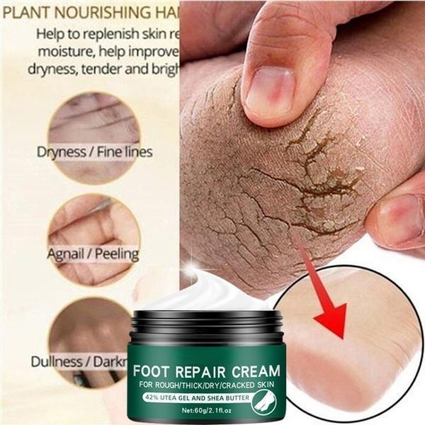 La più recente crema idratante riparatrice per la pelle delle mani e dei piedi anti-screpolature per piedi screpolati, secchi e screpolati, crema per i piedi riparatrice del tallone