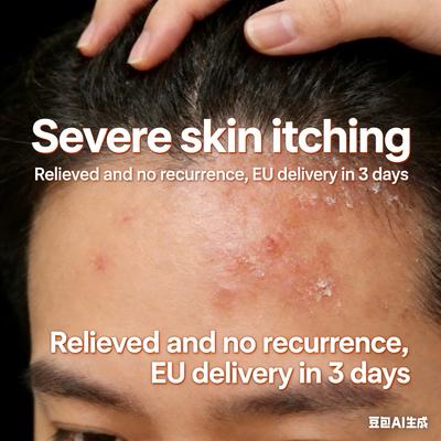 Anti-Bacterial Itch Cream - Potent Eczema Dermatitis Relief for Rash Peeling