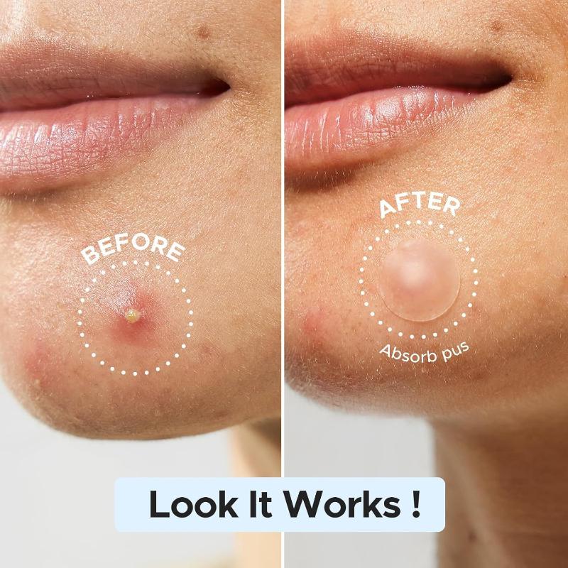 Large Pimple Patches Bulk For Face Hydrocolloid Multi-Shape Invisible Removal Acne Patches Covering Body Forehead Chin Blemishes
