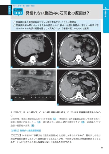 X-Ray! 10-Second Imaging Diagnostics: Practical Knowledge Learned from Influencers
