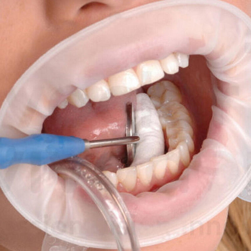 

5 шт., мягкие стоматологические стерильные резиновые втягивающие приспособления для щек, открывалка для рта