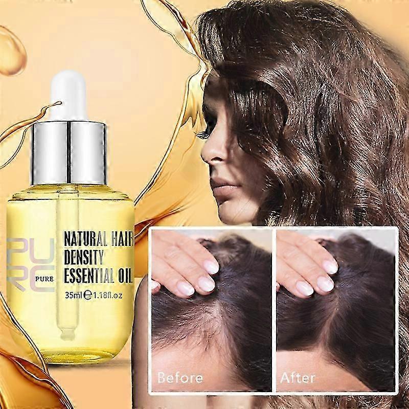 3pcs PURC Natural Hair Growth Essence Thickener Ginger Regrowth Serum Treatments Oil