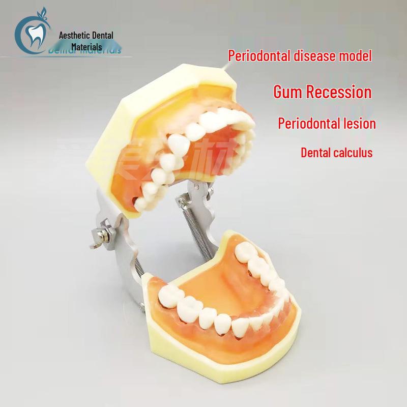 Dental Periodontal Model for Gingival, Supragingival, and Subgingival Scaling Practice Periodontal Model