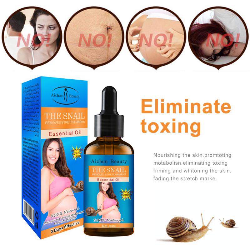 snail remove stretch marks cream