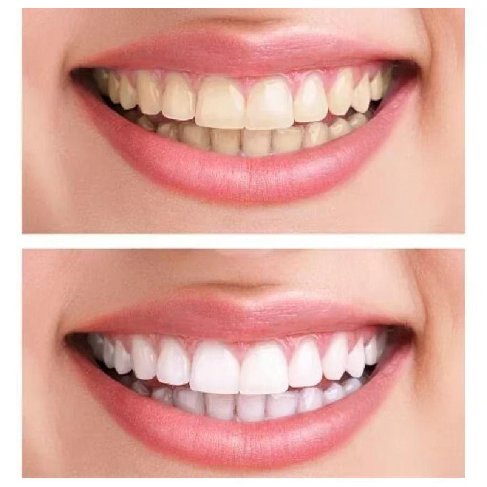 Whitening Temporary Fake Tooth DIY Cosmetic Dental Veneer Oral Care Veneer Dentures Teeth Makeup