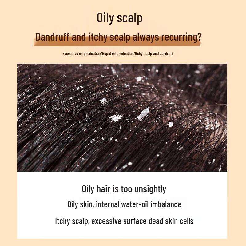 ZIYUAN Anti-Dandruff & Oil Control Shampoo