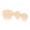 Dental 4 Times Implant Teeth Model Analysis Crown Bridge Demonstration Removable Model Dentistry Study Training Teaching Model