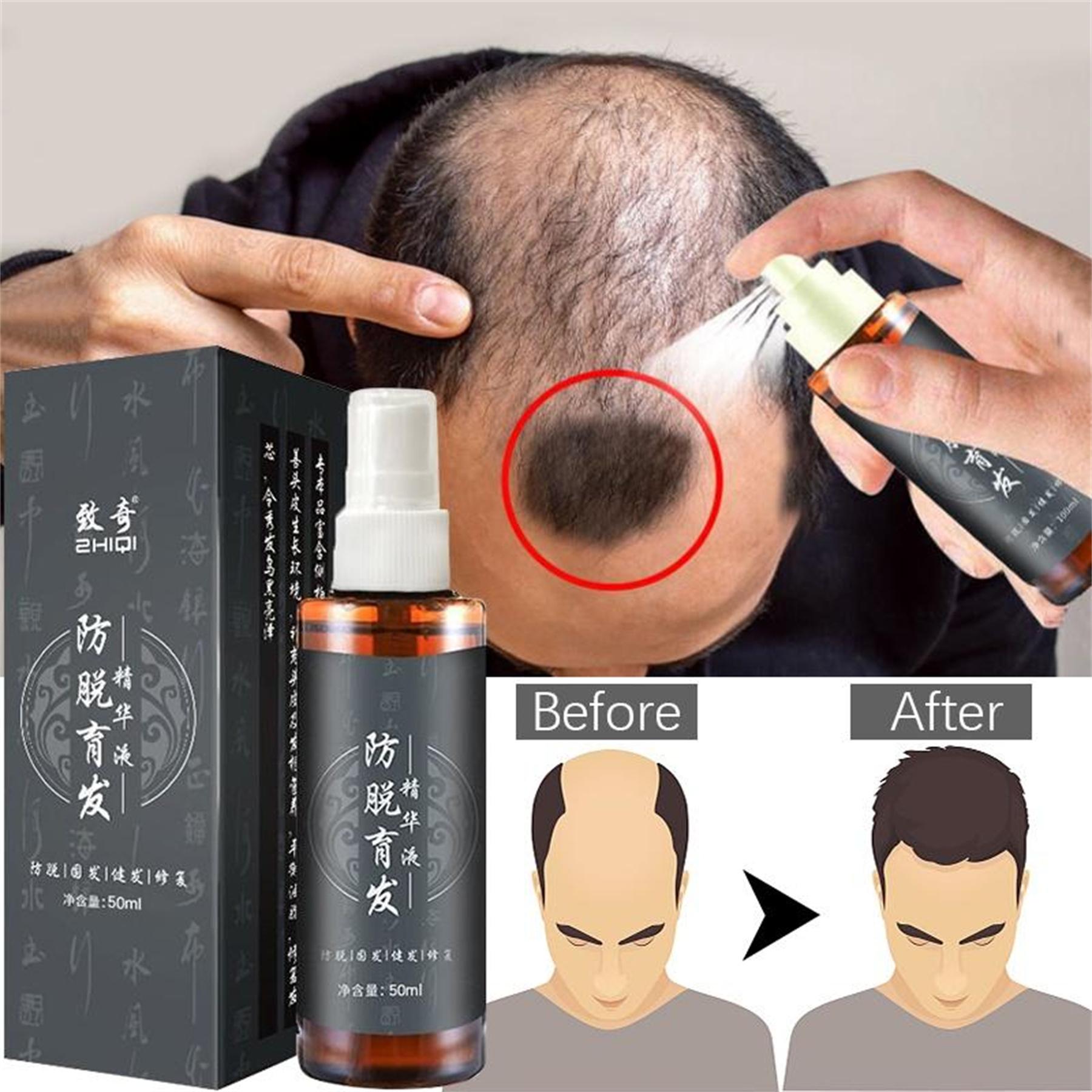 

Hair Treatment - Глубоко питательный кондиционер для поврежденных и сухих волос