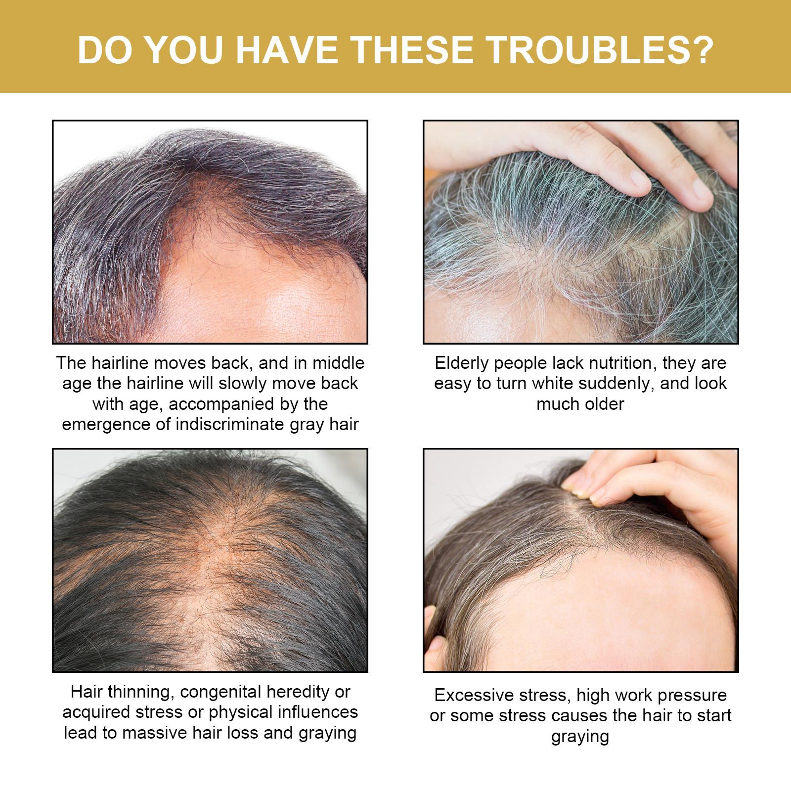 Шампунь Black For Hair Восстанавливающий шампунь Black For Hair — фото 4