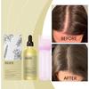EELHOE Plant Care Essential Oil Set Nourishes Improves Quality Frizz Smooth Soft  Moist And Glossy Hair