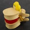 1:1.5 Lumbar Disc Herniation Demonstration Model Study Learn Human Spine
