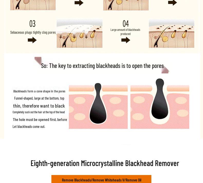Best-Selling Electric Blackhead and Acne Remover for Home Use