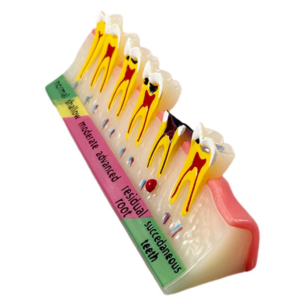 Dental Implant Teaching Model & Toothbrush Preparation Resin Mold