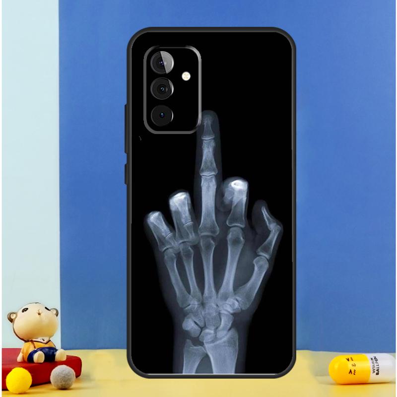 Skeleton Middle Finger Case For Samsung Galaxy A16 A36 A56 A06 A54 A34 A14 A13 A53 A12 A22 A32 A52 A35 A17 A15 A55