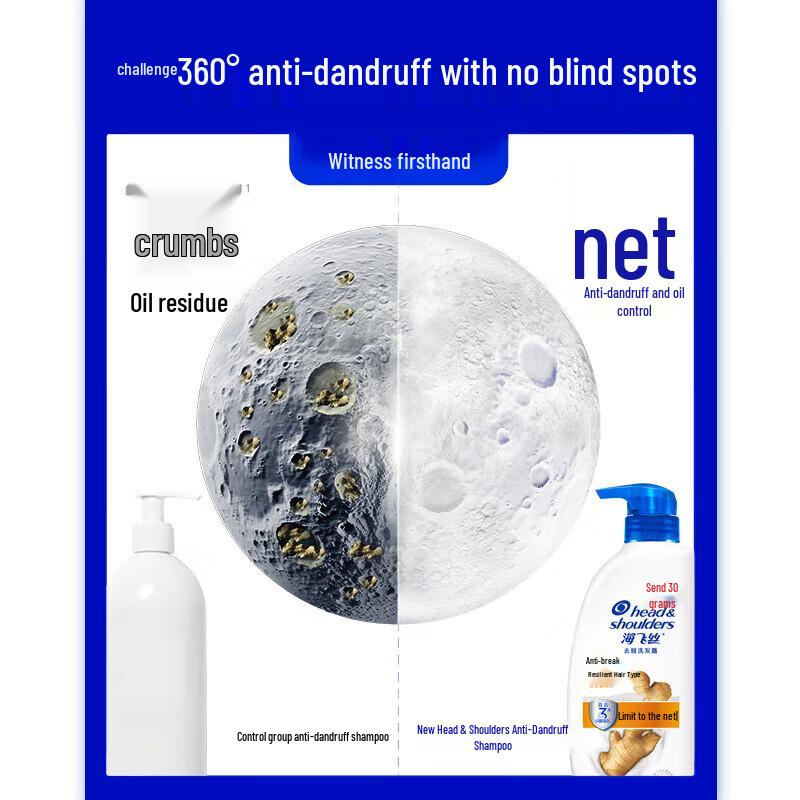 Head & Shoulders Anti-Dandruff Anti-Breakage Ginger Shampoo 430g
