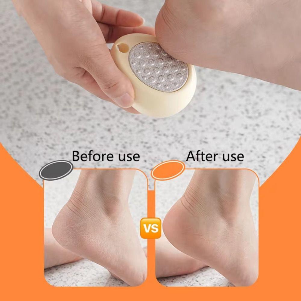 Ergonomic Pedicure Scraper Foot File Portable Dead Skin Callus Remover  Dry Dead Skin
