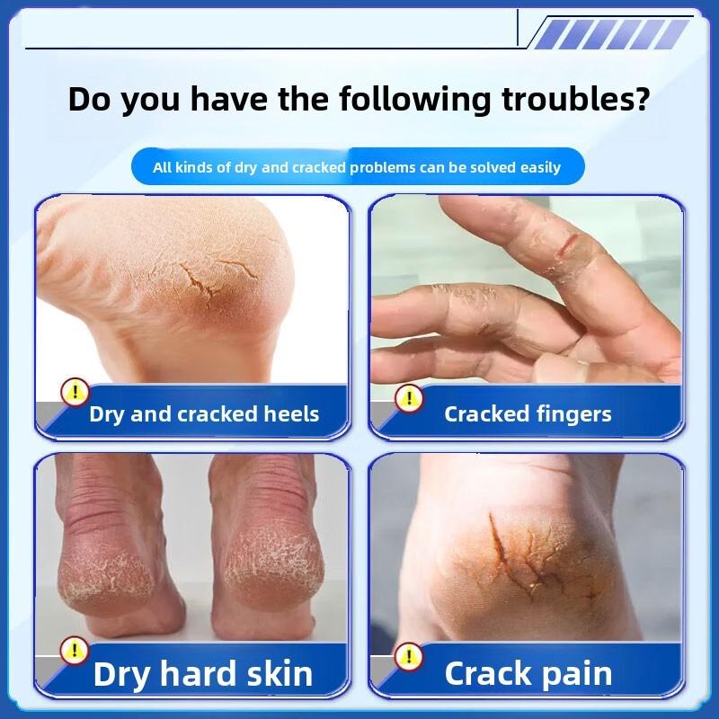 Botanische Kräuter Beruhigende Creme, Geeignet für trockene Hände und rissige Füße